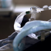 A patient with Covid-19 on breathing support lies in a bed in an intensive care unit.
