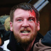 Close-up photo of grinning face with blood streaming down forehead
