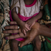 A woman holds the hands of her malnourished daughter in the Tigray region of Ethiopia.