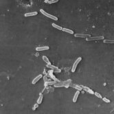 This image shows rod-shaped Pseudomonas aeruginosa bacteria.
