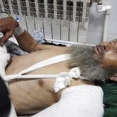 A man wounded during a bombing at a mosque in Afghanistan receives treatment.
