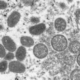 This electron microscope image shows monkeypox virions.