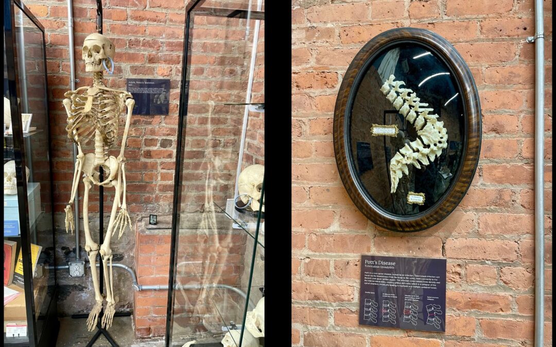Massachusetts Supreme Court resurrects Harvard cadaver case 